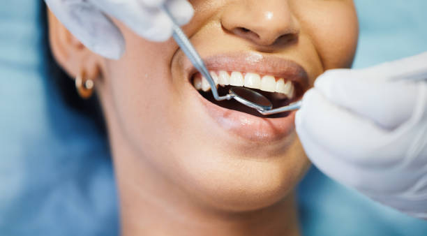 Best Broken or Cracked Tooth Emergency Dentist in Chieand, FL